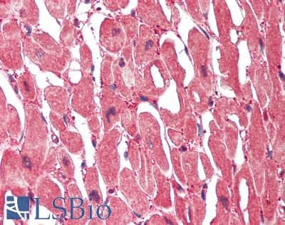 IHC-plus™ CAST / Calpastatin Antibody