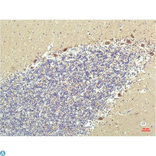 PPARD / PPAR Delta Antibody