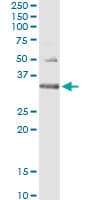 HUS1 Antibody (clone 2B12)