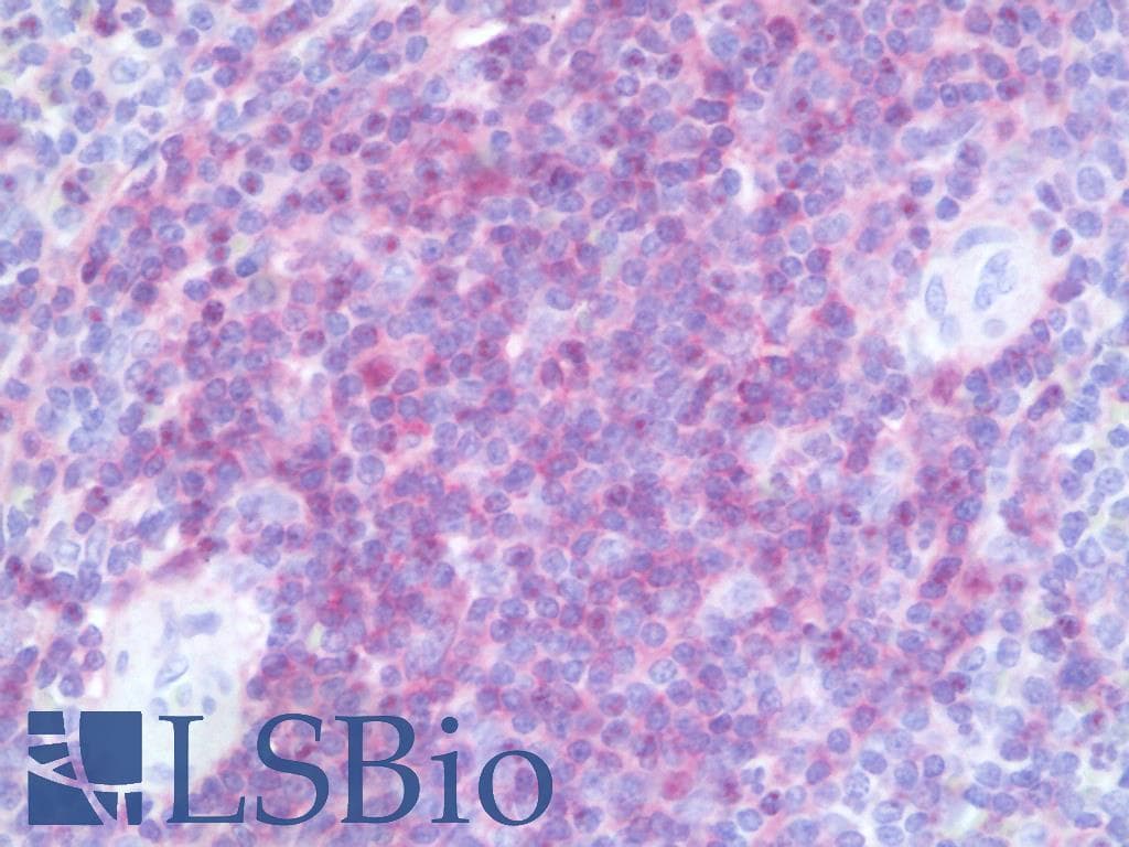 PathPlus™ CD4 Antibody (clone 5D9)