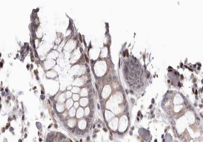 Polyclonal Rabbit anti-Human CDC37 Antibody (phospho-Ser13, IHC, IF, WB)