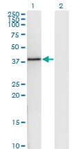 DNAJB6 Antibody (clone 1A5)