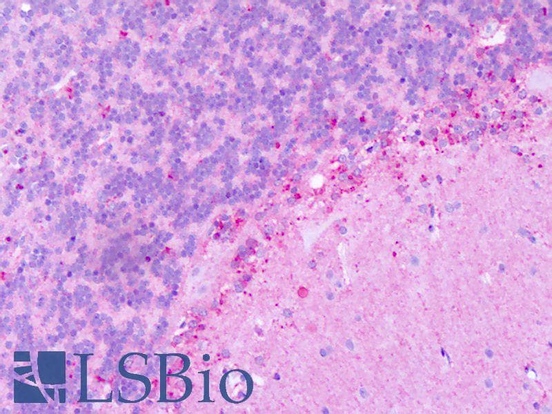 IHC-plus™ Polyclonal Rabbit anti-Human KISS1R / GPR54 Antibody (C-Terminus, IHC)