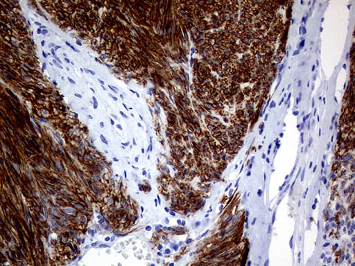 ANO1 / DOG1 / TMEM16A Antibody (aa1-333, clone OTI1C6)