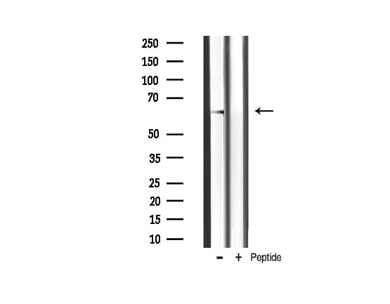 Polyclonal Rabbit anti-Human AKT2 Antibody (phospho-Ser474, IHC, IF, WB)