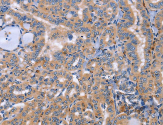 Polyclonal Rabbit anti-Human SIGLEC7 / CD328 Antibody (IHC, WB)