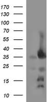 EPCAM Antibody (clone OTI3B2)