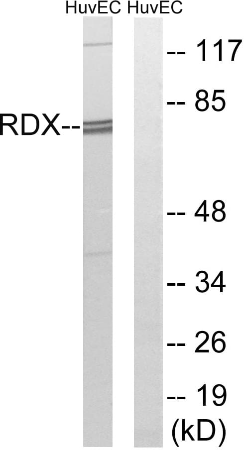 IHC-plus™ RDX / Radixin Antibody (aa142-191)
