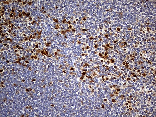 PPP2R1B Antibody (aa19-601, clone OTI8B6)