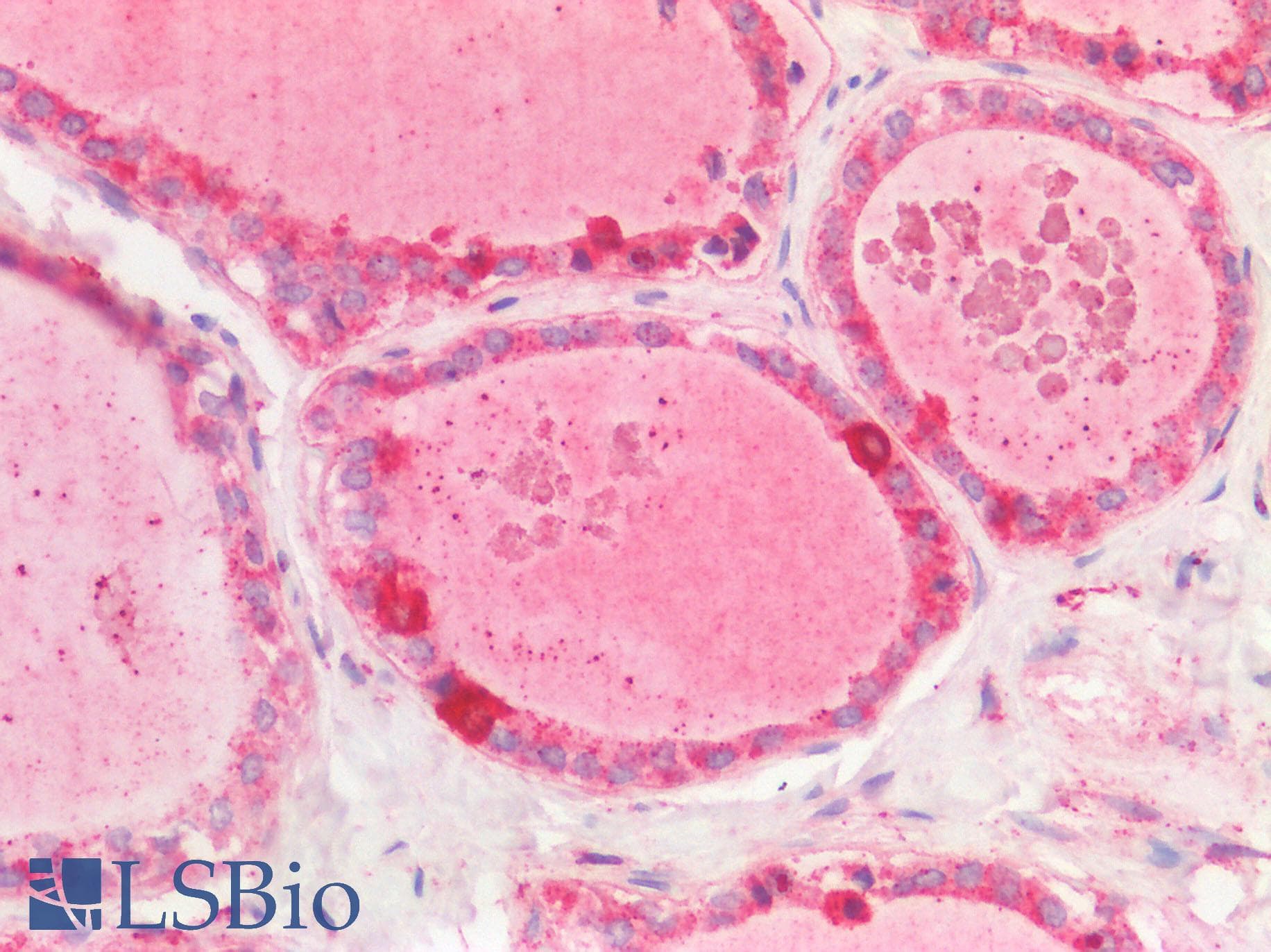 IHC-plus™ IFIH1 / MDA5 Antibody