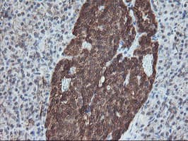 Monoclonal Mouse anti-Human SKIL / SNO / SnoN Antibody (clone OTI3E2, IHC, WB)