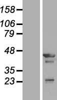 TMOD3 / Tropomodulin 3 Protein (Over-Expression Lysate Myc-DDK (Flag))