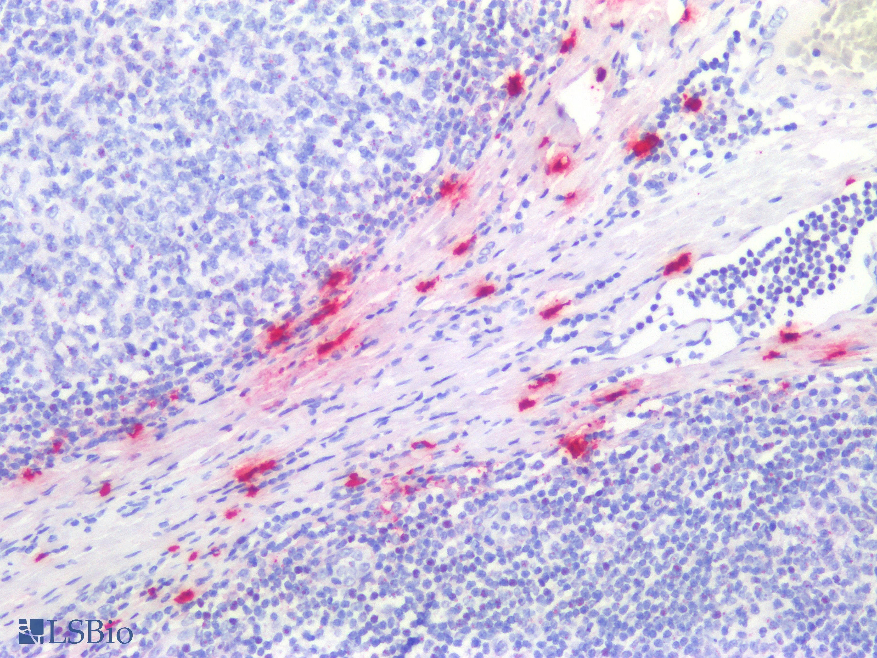 PathPlus™ TPSAB1 / Mast Cell Tryptase Antibody (clone 1.N.5)