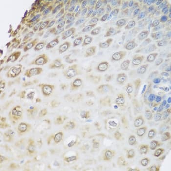 GRPEL2 Antibody