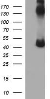 Monoclonal Mouse anti-Human CALR3 Antibody (clone OTI1D1, WB)