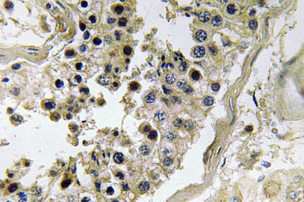 Polyclonal Rabbit anti-Human INHBC Antibody (aa80-129, IHC, WB)