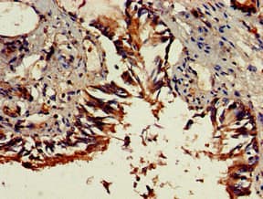 Polyclonal Rabbit anti-Human DENND1C Antibody (IHC, WB)