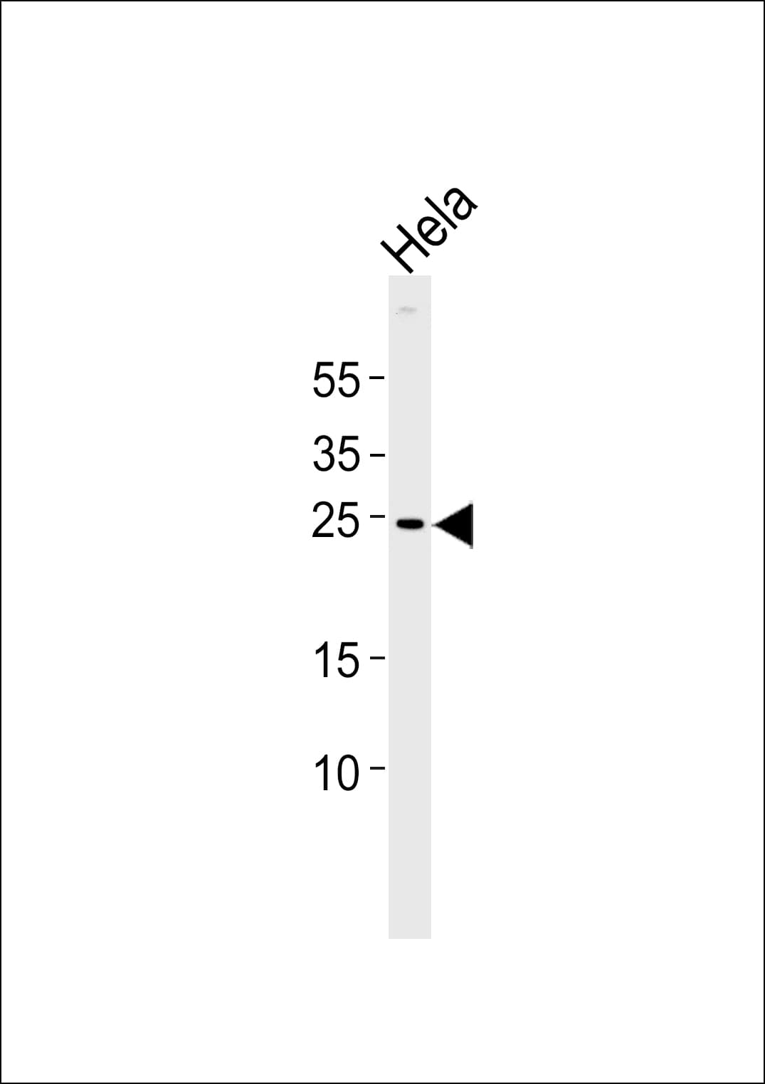 Polyclonal Rabbit anti-Human ZNRF2 Antibody (aa2-36, WB)