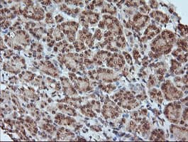 MAP2K1 / MKK1 / MEK1 Antibody (clone OTI5A11)