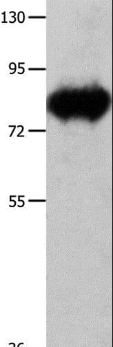 Polyclonal Rabbit anti-Human ECE-1 Antibody (WB)