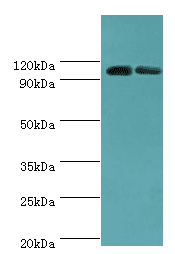 Polyclonal Rabbit anti-Human ALDH1L1 Antibody (aa1-250, IHC, WB)