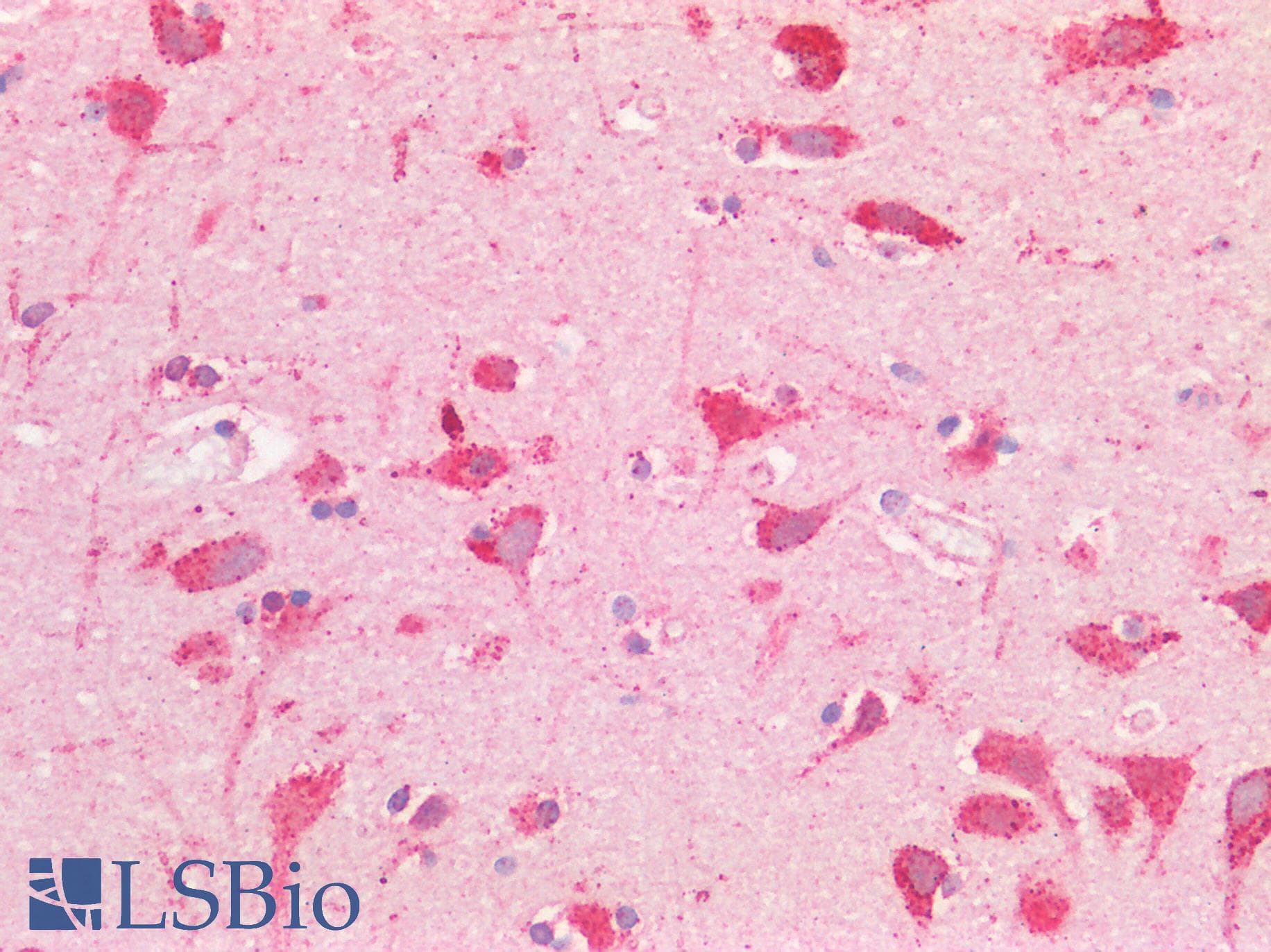 CHMP2A Antibody (N-Terminus)