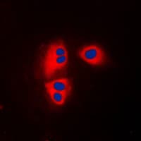 Polyclonal Rabbit anti-Human MRPL32 Antibody (Internal, IF, WB)