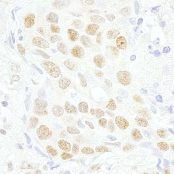 Polyclonal Rabbit anti-Human MAZ Antibody (aa427-477, IHC)