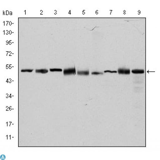 CCT2 / CCT Beta Antibody
