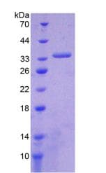 Human ABCA1 Protein (Recombinant His-T7)