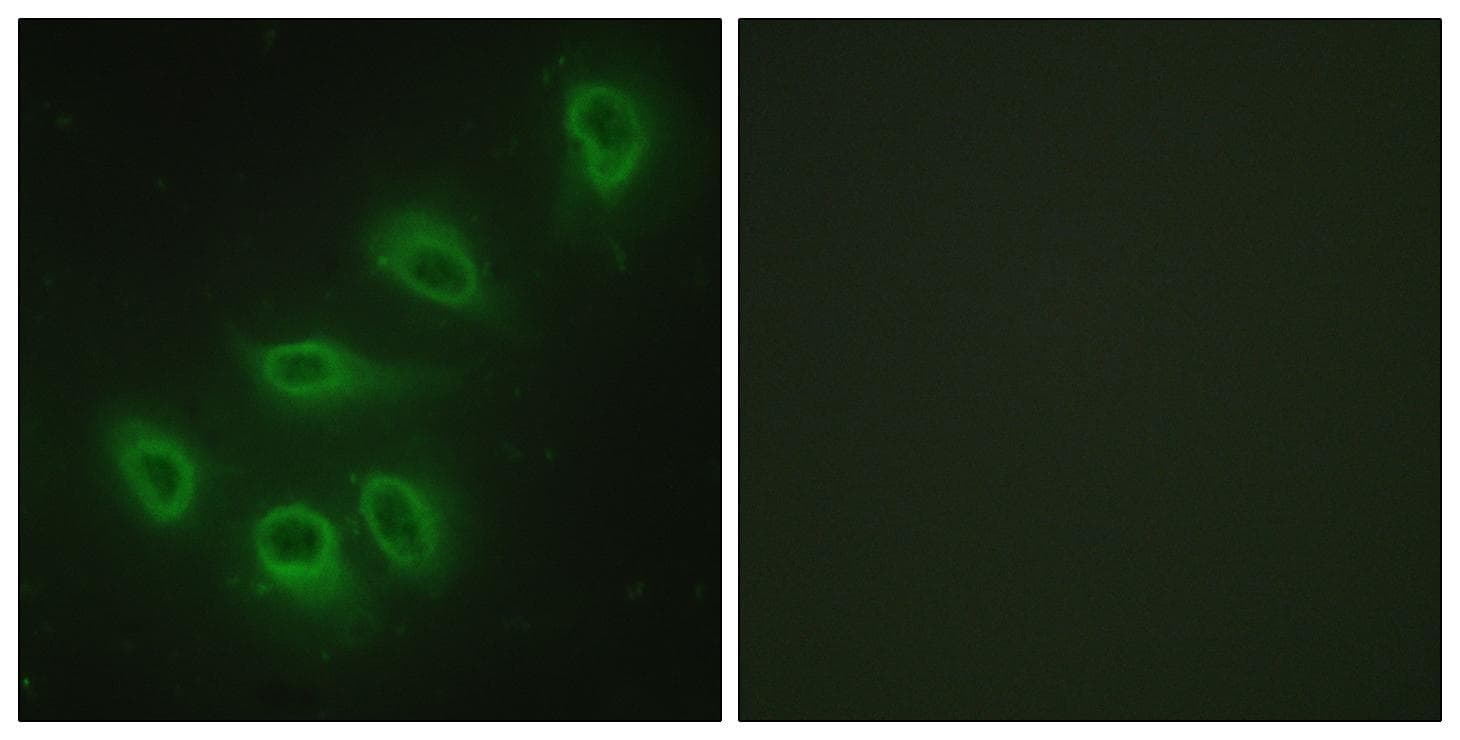 NOS3 / eNOS Antibody (p1179)