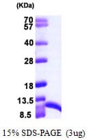 Human S100A6 / Calcyclin Protein (Recombinant His)