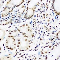 HDGFRP2 Antibody