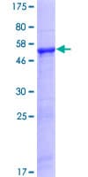 Human EBS / NAT9 Protein (Recombinant GST)