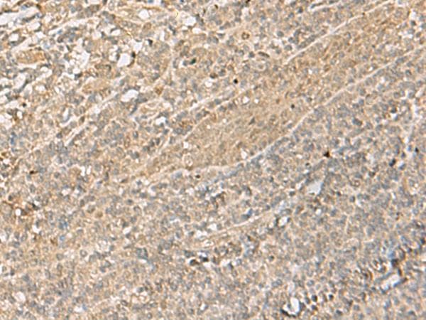 Polyclonal Rabbit anti-Human IPO11 / Importin 11 Antibody (IHC, WB)
