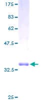 Human DLEU1 Protein (Recombinant GST)