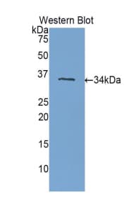 PLXNB1 / Plexin-B1 Antibody (aa1780-2042)