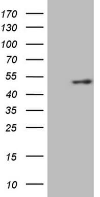 KCTD9 Antibody (aa1-223, clone OTI4E9, Carrier-free)