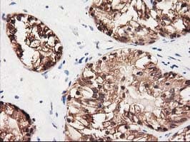 GALE / UDP-Glucose 4-Epimerase Antibody (clone OTI1C4)