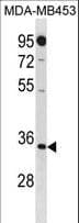 MTAP Antibody (aa8-37)