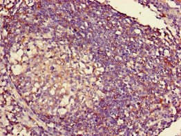 Polyclonal Rabbit anti-Human HLA-C Antibody (Biotin, WB)
