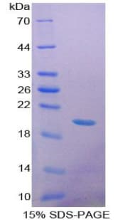 Rat GDF9 / GDF-9 Protein (Recombinant His-T7)