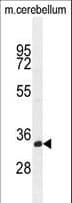 SARAF / TMEM66 Antibody (aa33-62)
