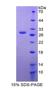 Human IGSF1 Protein (Recombinant His-T7)