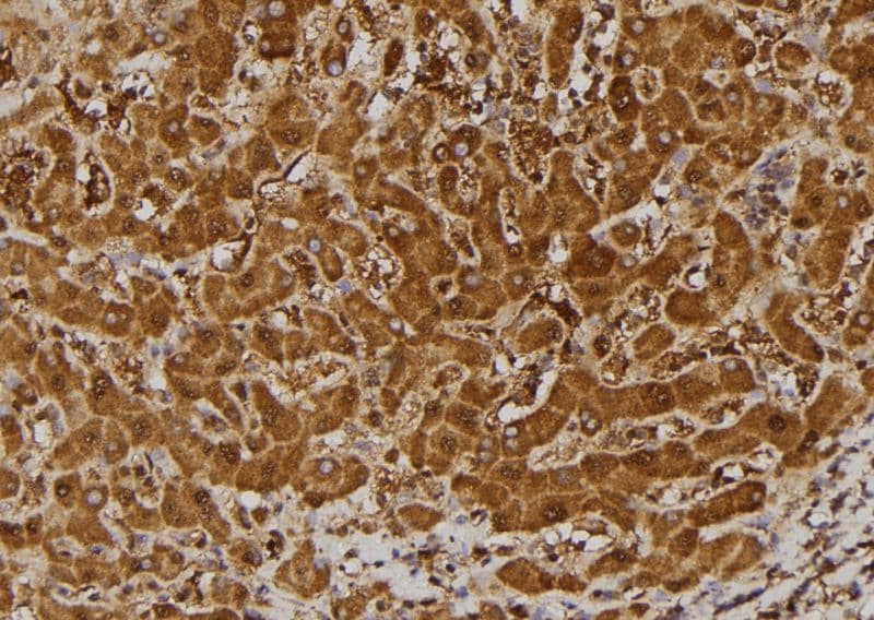 BCL2L1 / BCL-XL Antibody