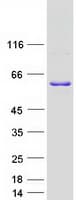 Human WBP4 Protein (Recombinant Myc-DDK (Flag))