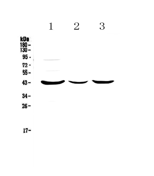 LPAR6 / P2RY5 / P2Y5 Antibody
