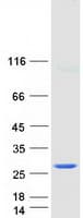 Human CBX5 / HP1 Alpha Protein (Recombinant Myc-DDK (Flag))