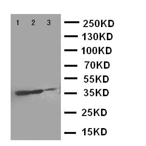 TNFRSF10A / DR4 Antibody (aa110-125)