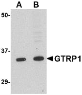 IHC-plus™ GRTP1 Antibody